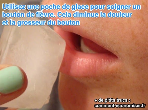 Usar un helado para curar un herpes labial