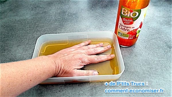 remojar sus manos en vinagre de sidra de manzana caliente para aliviar el eccema