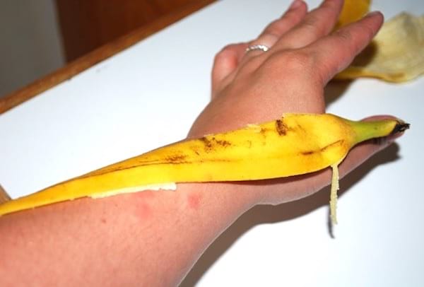 aliviar las picaduras de insectos con cáscara de plátano