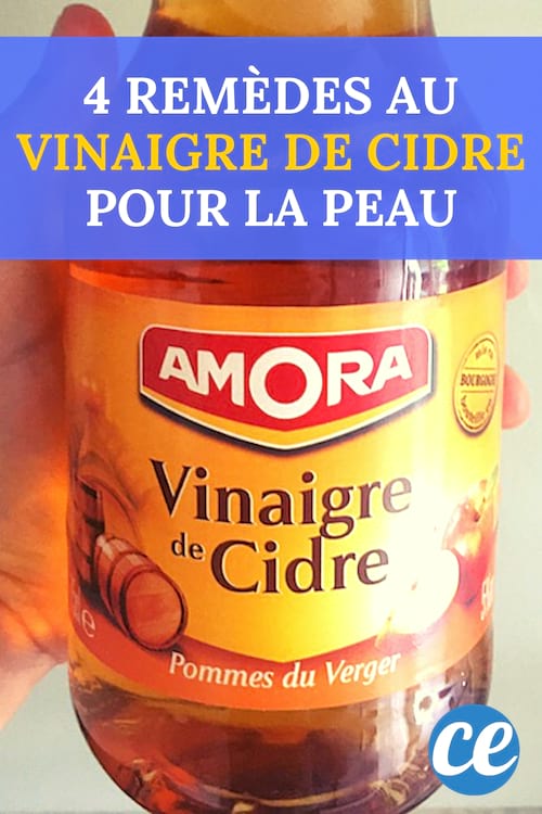 4 remedios de vinagre de sidra de manzana para la piel