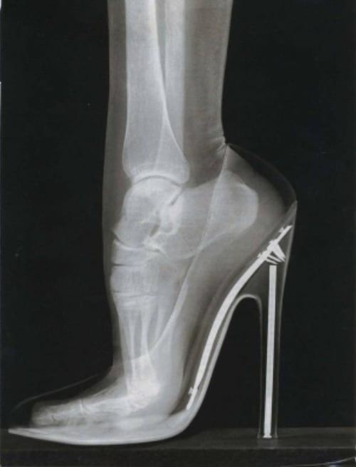 Una radiografía de un pie en un tacón de aguja.