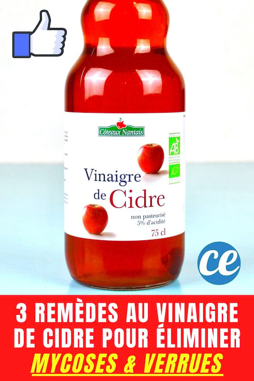 3 remedios de vinagre de sidra de manzana para deshacerse de micosis y verrugas.