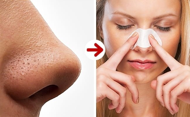 Els punts negres del nas es poden eliminar amb farina i mel