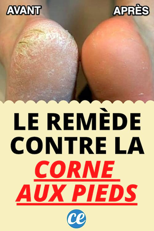 Corne aux Pieds: দাদির রেসিপি হু ওয়াকস বাই দ্য ফায়ার অফ গড!