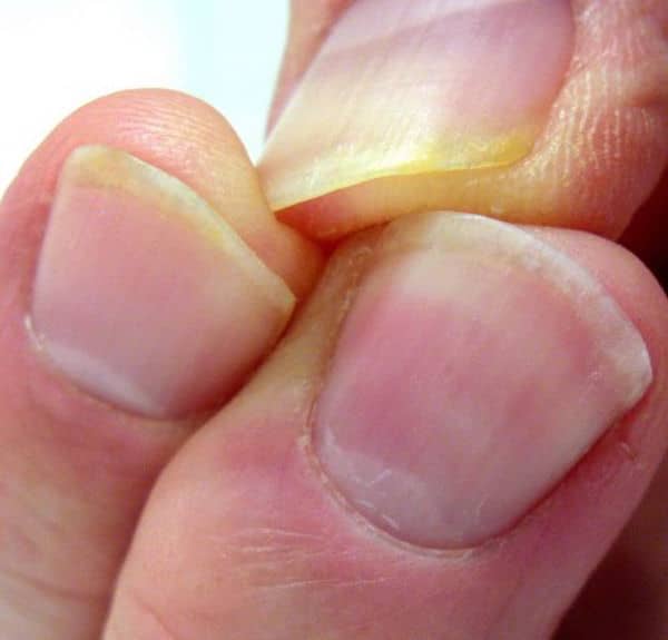 Elimine los rastros de nicotina de los dedos de los fumadores con pasta de dientes