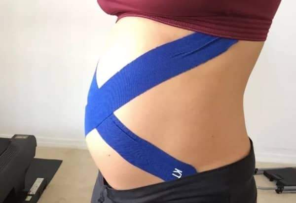 bandas de kenesio para aliviar el peso de la barriga durante el embarazo