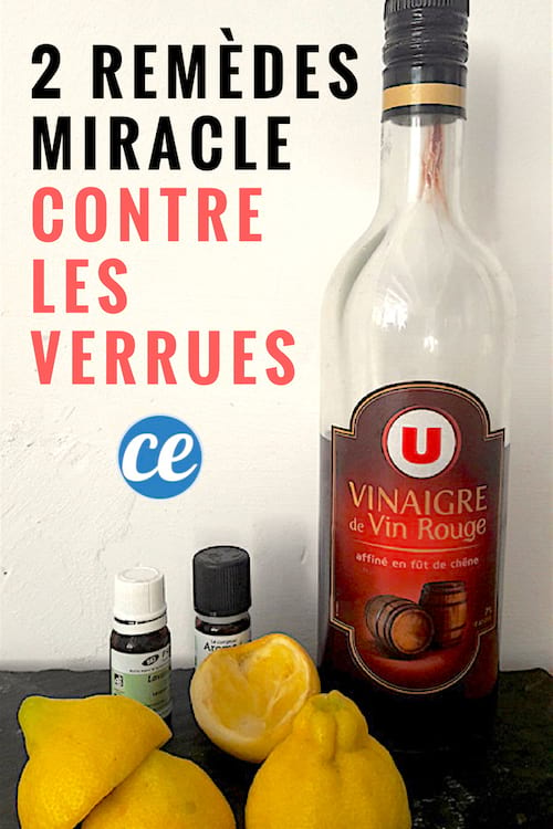 Remedios naturales eficaces para las verrugas con vinagre, aceites esenciales y limón