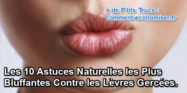 naturlige tips til sprukne læber