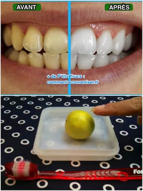 Use suco de limão para clarear os dentes
