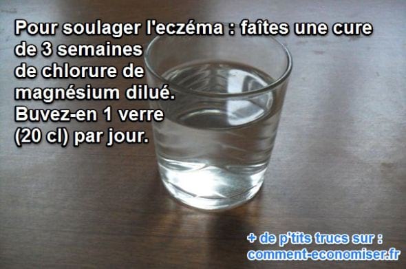 El cloruro de magnesio diluido en un vaso de agua es un remedio natural para aliviar el eccema.
