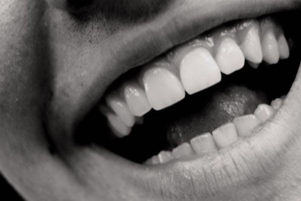 sonrisa de diente blanco