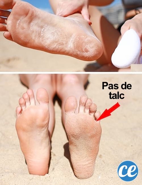 שים אבקת טלק על כפות הרגליים כדי למנוע שהחול יתקע